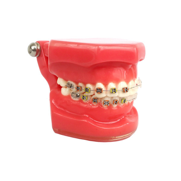 Dental Orthodontic Study Teeth Model With Ceramic &amp; Metal Brackets