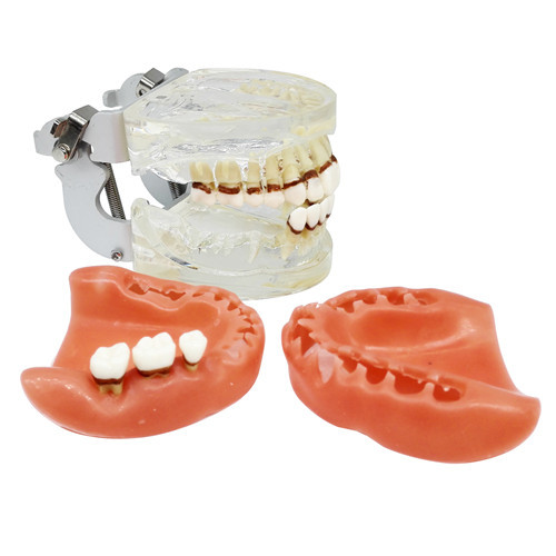 Dental Teeth Model Study Teach Standard Model Gums Removable Teeth