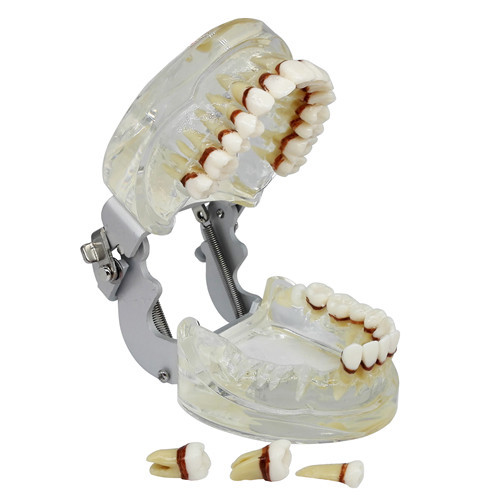 Dental Teeth Model Study Teach Standard Model Gums Removable Teeth