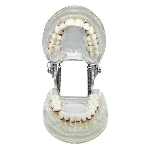 Dental Teeth Model Study Teach Standard Model Gums Removable Teeth