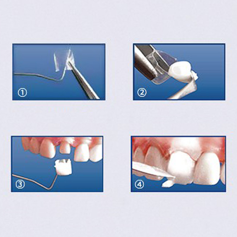 Dental Transparent Crown Posterior Matrices Matrix for Adult TOP BM 1.911 Features 64pcs
