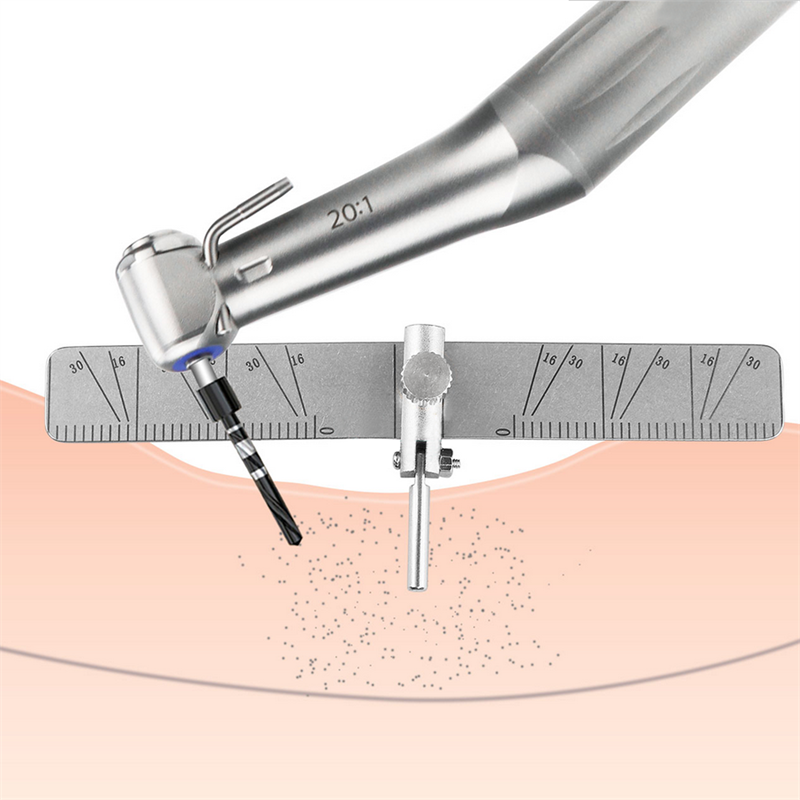 Dental Implant Locating Guide Surgical Positioning Locator Angle Ruler Guage