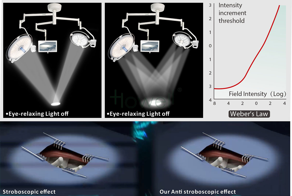 Do you know the basics of operating room lighting?