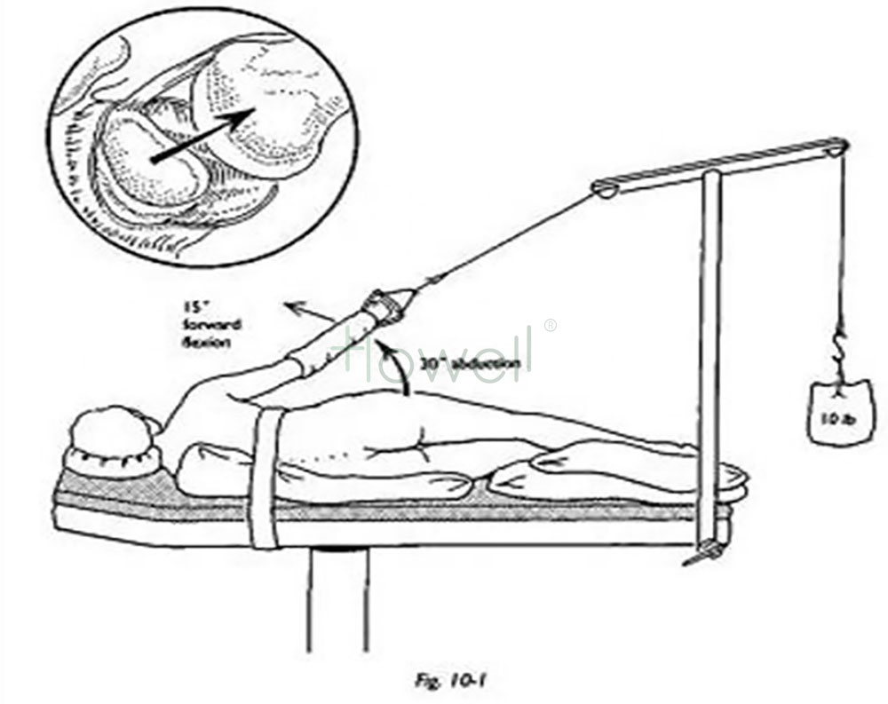 Lateral Shoulder Positioner