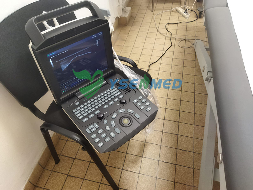 Customer from France is satisfied with YSENMED YSB-M5 portable color doppler ultrasound machine.