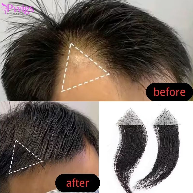 Men's V Loop Frontal Toupee Men's PU Human Hair Hairline 100% Real Human Hair Forehead Hair Patch Hairpiece Sideburns Toupee Men Invisible Seamless Ultra Thin Skin PU Men's Hair System 1B Color