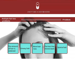 Portable Mini Electric Ionic Hair Brush Anti-Static Scalp Head Massage Comb Hair loss machine treatment Care