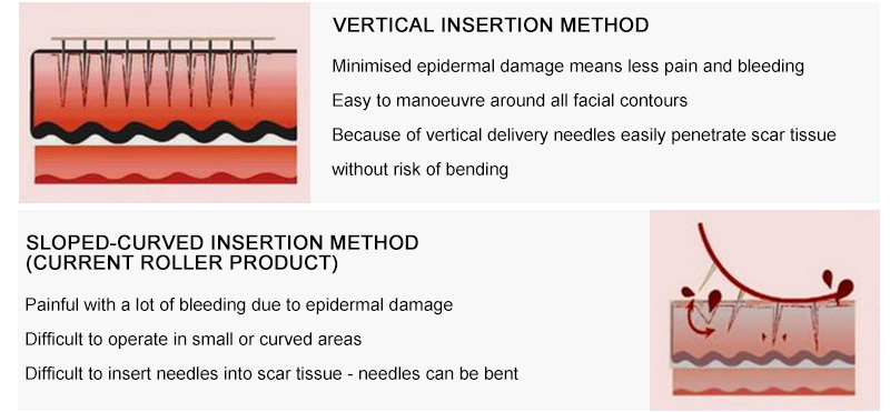 derma stamp vs derma roller