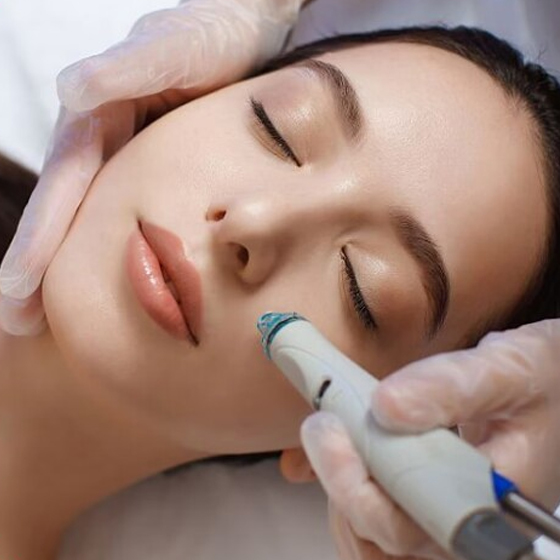 hydra dermabrasion treatment