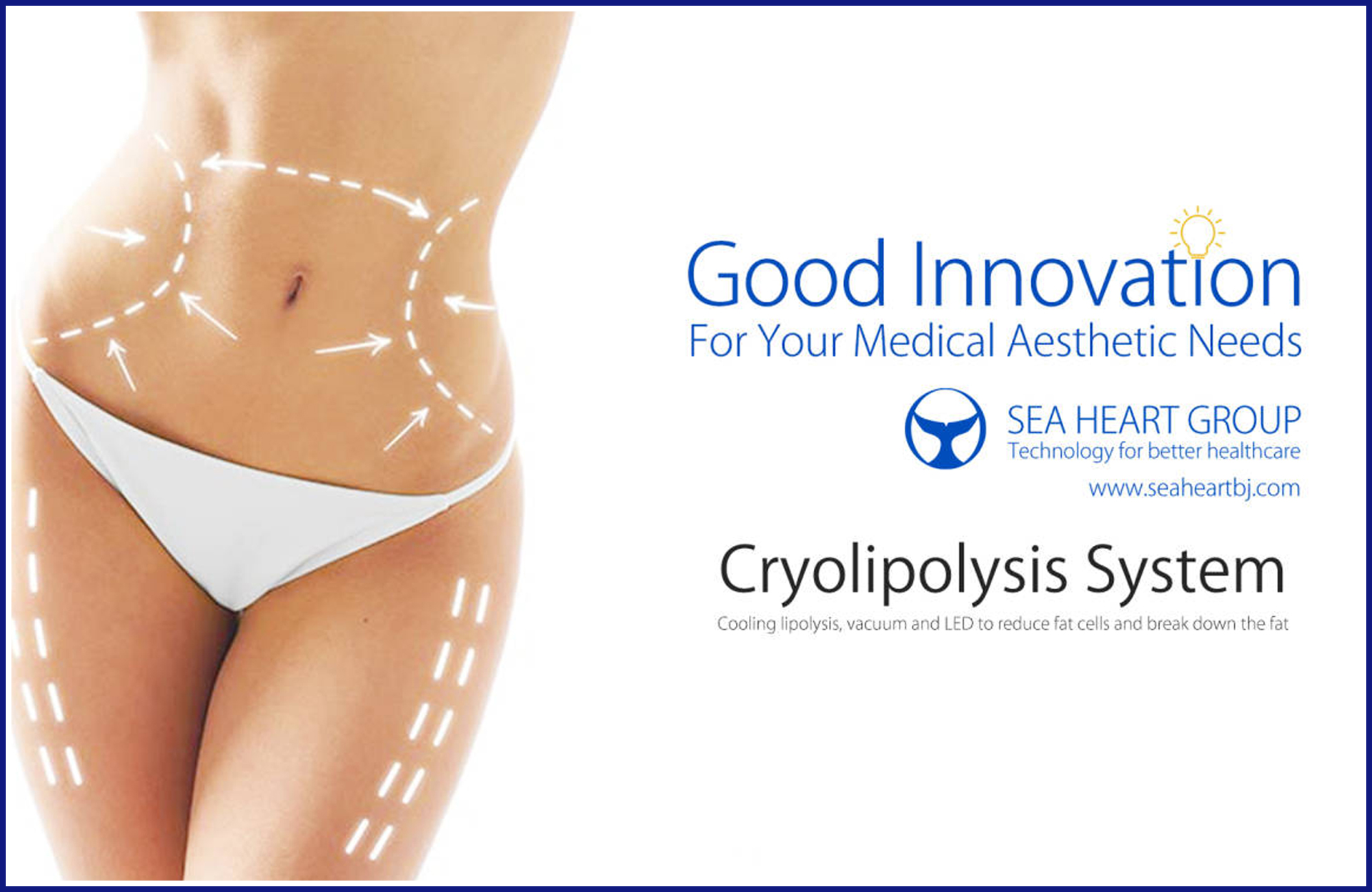 Tips about Coolsculpting and Cryolipolysis