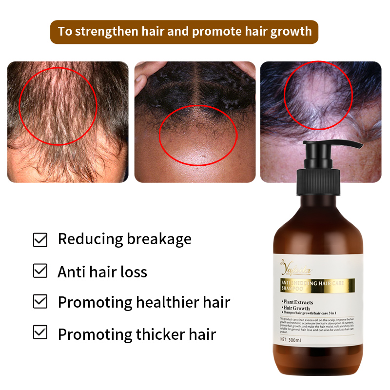 Peppermint Rosemary Hair Regrowth shampoo