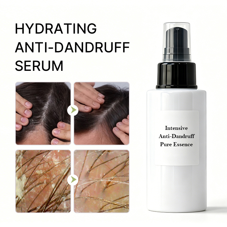 Intensive Anti-Dandruff Scalp Serum