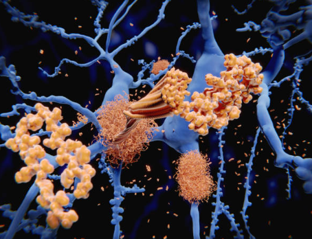 The Benefits of Piracetam: Improving Memory and Focus