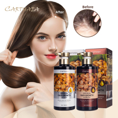 New 500ml castor oil hair growth shampoo anti hair loss shampoo