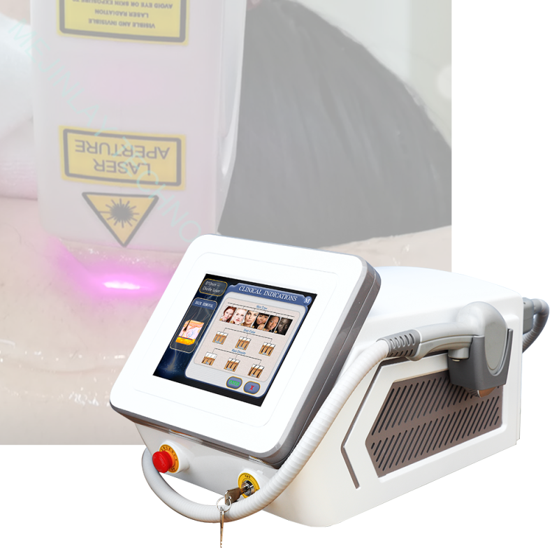 Alma Laser Soprano Ice Platinum 755 808 1064nm 3 waves hair removal machine