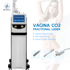 Competitive CO2 fractional and vaginal tightening laser