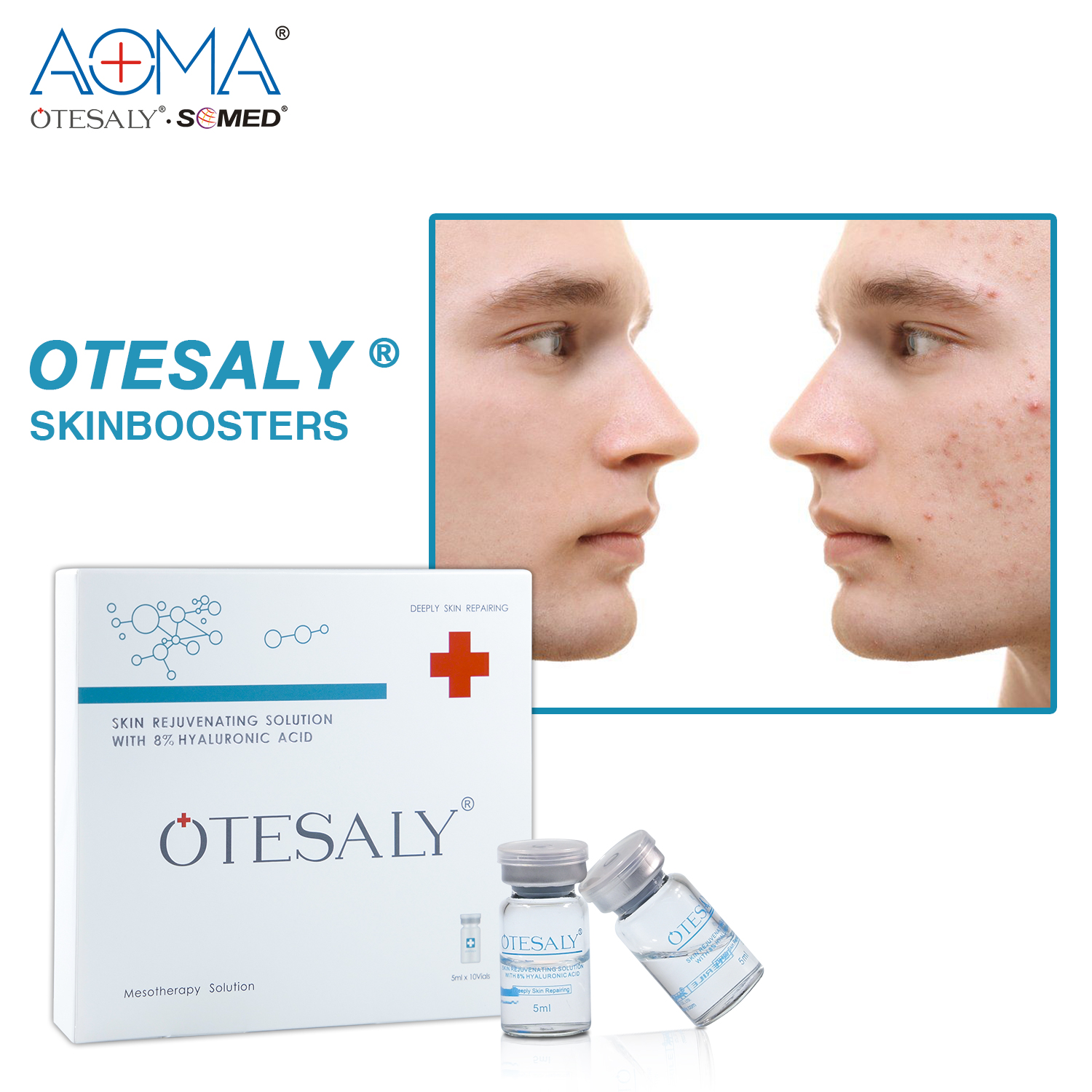 Otesaly Skin Rejuvenation Mesotherapy Serum Skin Booster For Anti Aging