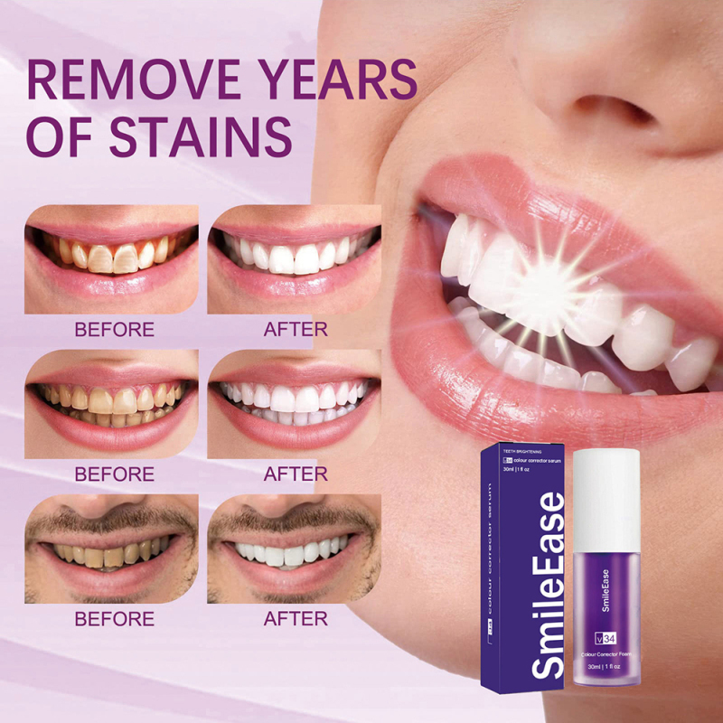V34 Original SmileEase Purple Whitening Toothpaste Reduce Yellow Removal Smoke Stain Toothpaste Oral Tooth Whitening Products