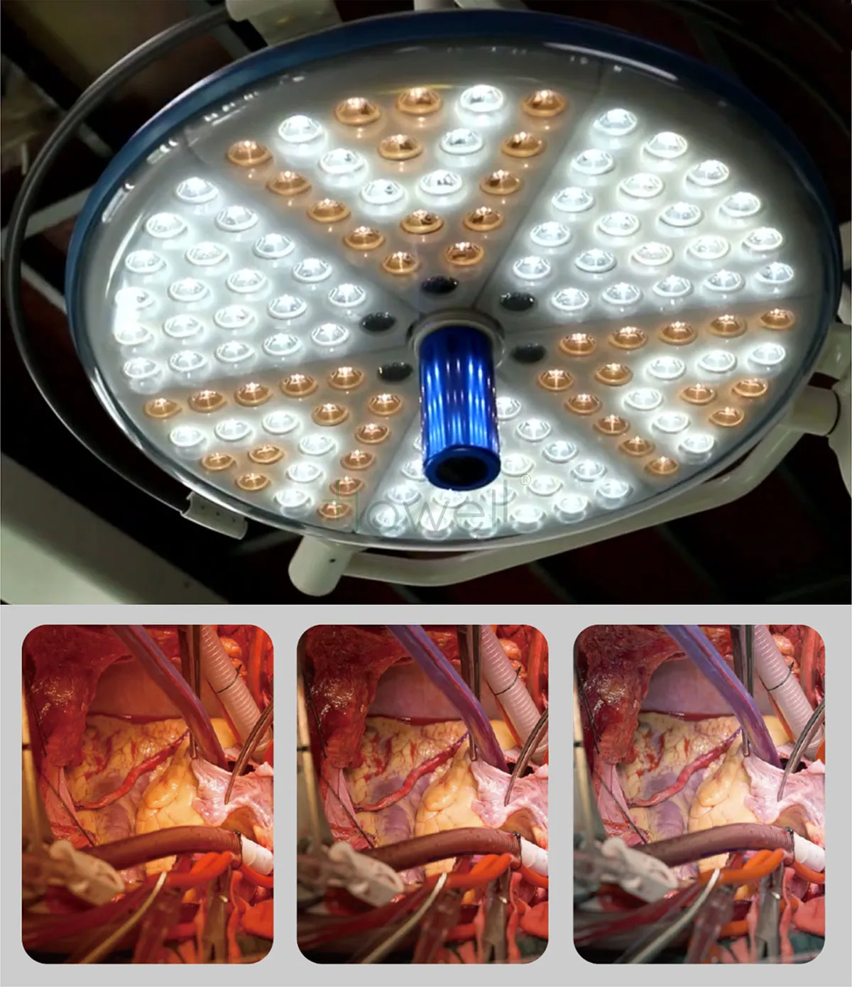 operating Shadowless Lamp