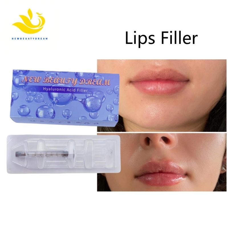 Dermal Filler-Derm 3ml for Lips Filler