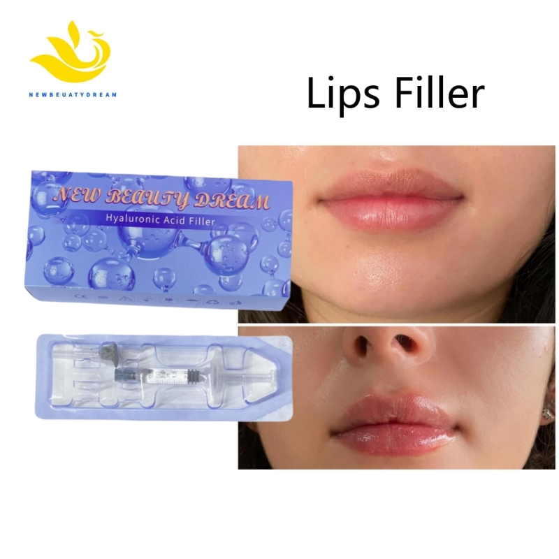 Dermal Filler-Derm 2ml for Lips Filler