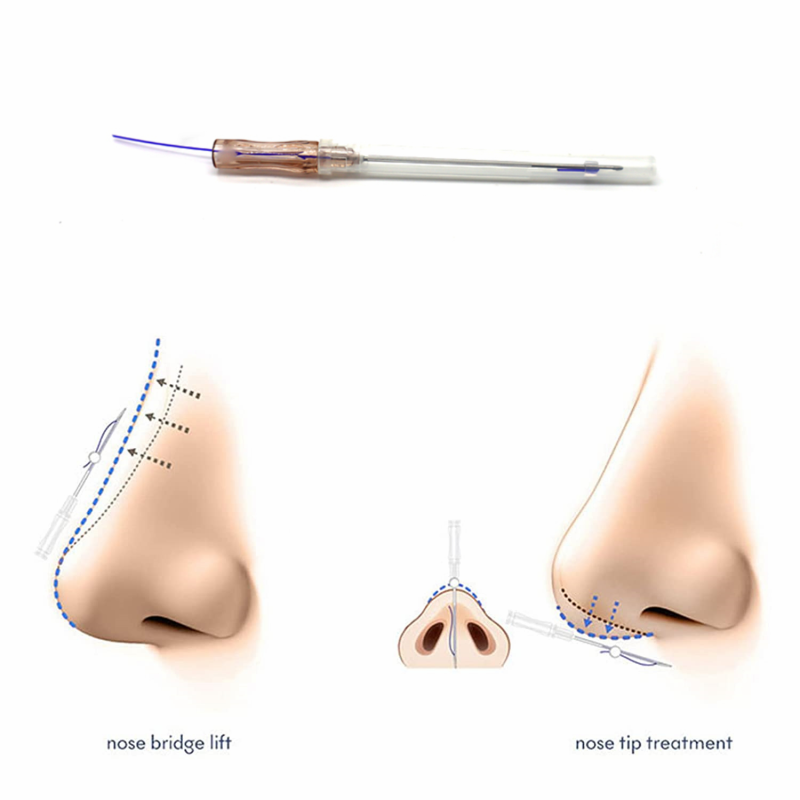 PDO-Nose Thread