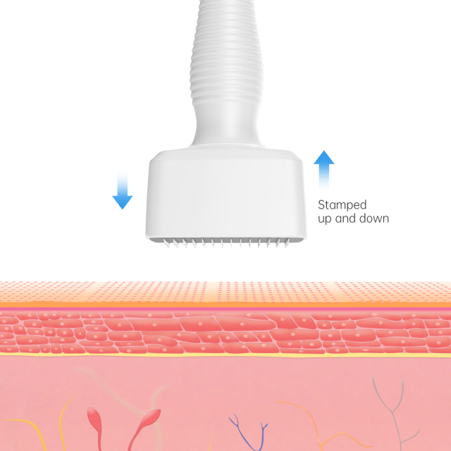 DRS140a derma roller