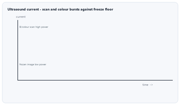 animated ultrasound current profile live scan colour Doppler freeze and standby modes
