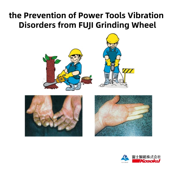 HAVS impact on hand nerves from industrial power tool use
