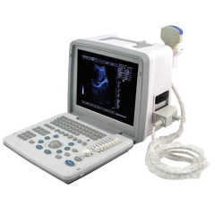 Portable 2D Ultrasound Diagnostic Urgent Care Ultrasound Machine,Fatali Medical equipment