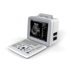 Portable 2D Ultrasound Diagnostic Urgent Care Ultrasound Machine,Fatali Medical equipment