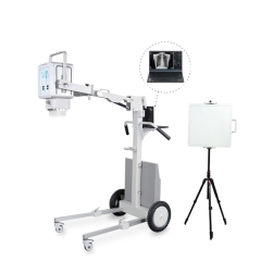 FTLF056-PD Digital Portable X-Ray Machine with DR 5.6KW Medical Imaging Products,Fatali Medical equipment