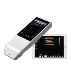 Hospital Portable Wireless Ultrasound Machine - Easy Diagnosis Anywhere,Fatali Medical equipment