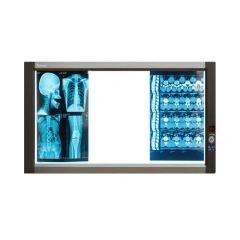 FTL-GPD03 X Ray Machine Triple LED XRay View Box,Fatali Medical equipment