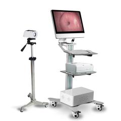 Digital Portable Trolley Gynecology Colposcope,Fatali Medical equipment