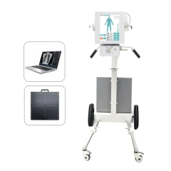 5.6kW Mobile Full Body X-ray Diagnostic System for Hospital,Fatali Medical equipment