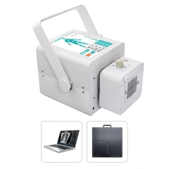 5.6kW Mobile Full Body X-ray Diagnostic System for Hospital,Fatali Medical equipment