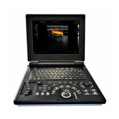 Portable Ultrasound Machine FTL-E20,Fatali Medical equipment