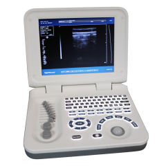 Portable Diagnostic Ultrasound Machine,Fatali Medical equipment