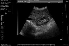 Portable Diagnostic Ultrasound Machine,Fatali Medical equipment