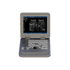 Notebook B/W Ultrasound Machine FTL-S70A,Fatali Medical equipment
