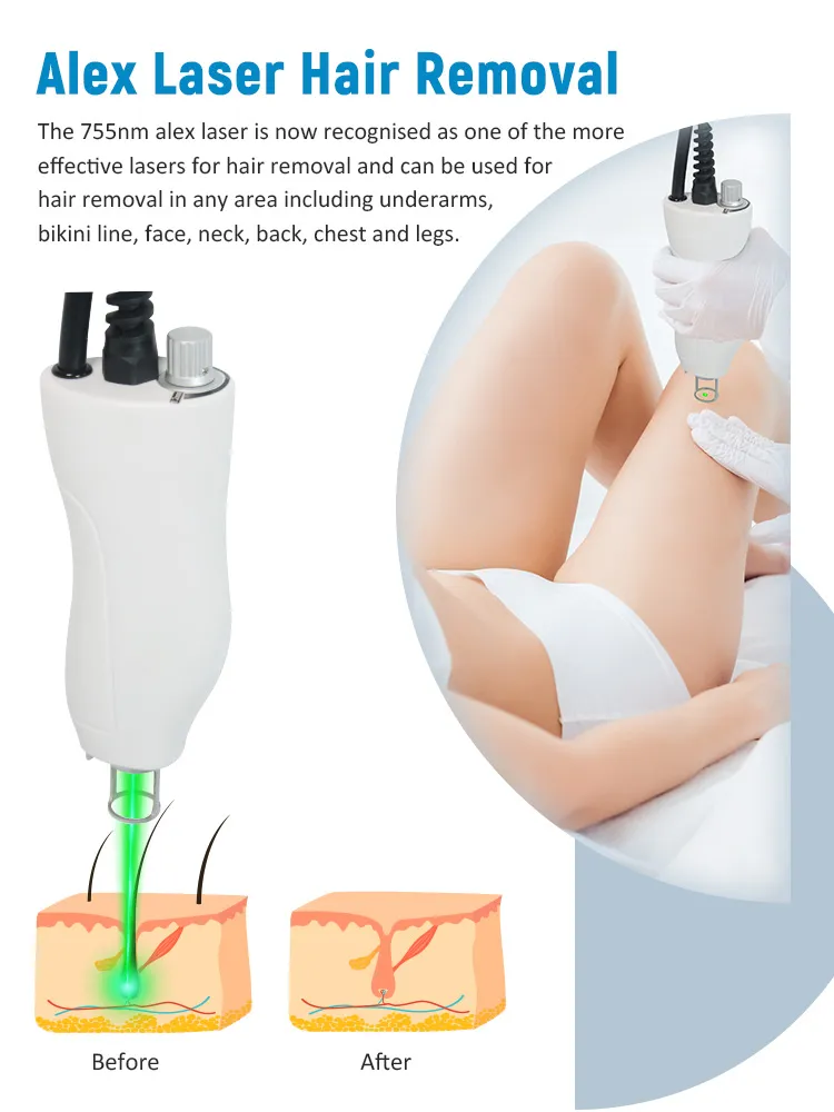 Alexandrite and Nd:YAG Laser for Hair Removal