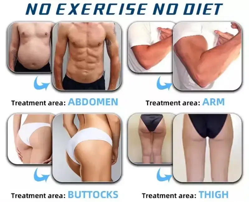 EMS Sculpt Machine Before and After