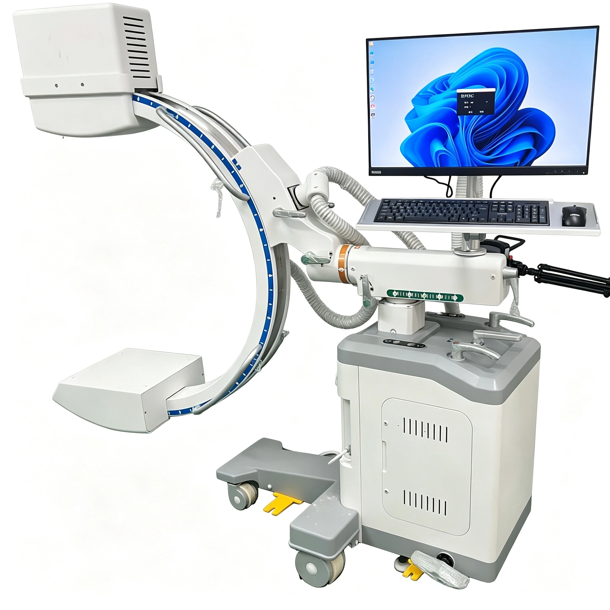 Mobile C-arm X-ray system used for intraoperative fluoroscopy in surgery