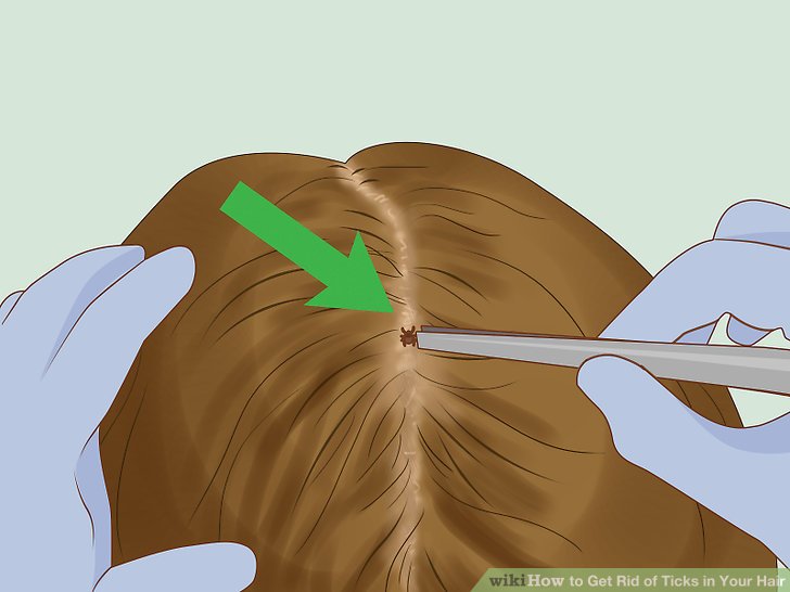 How to Get Rid of Ticks in Your Hair