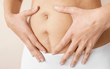 Caesarean Section