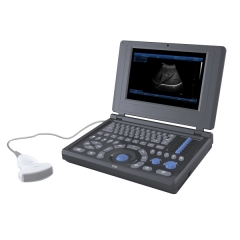 Laptop Ultrasound Scanner YSD4200