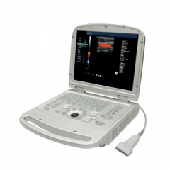 Portable Color Dopler Ultrasound Scanner YSD516