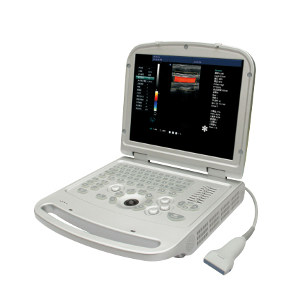 Portable Color Dopler Ultrasound Scanner YSD516