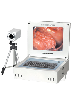 Portable Digital Colposcope YSD6002A